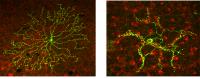 Defects in mouse starburst amacrine cells.